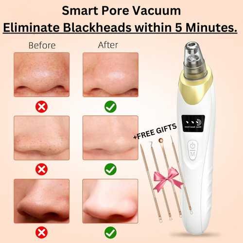 Smart Pore Vacuum