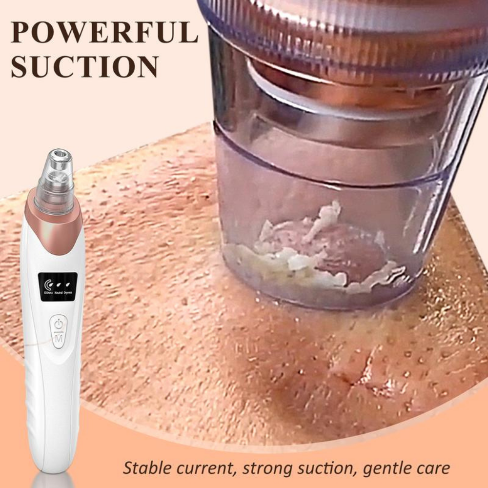 Smart Pore Vacuum