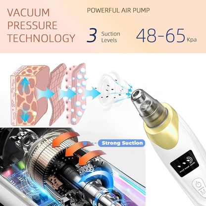 Smart Pore Vacuum