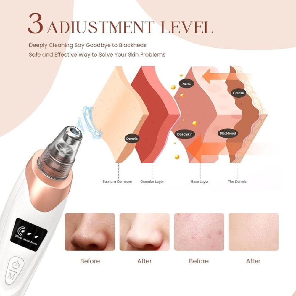 Smart Pore Vacuum